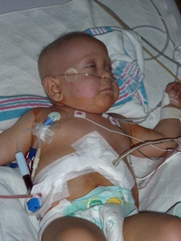a photo of leo giaudrone as a baby with tubes in the hospital